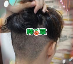 -大麦微针植发全国连锁