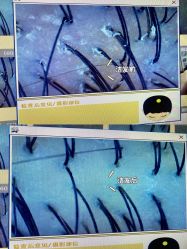 -丝客富脱发养发头皮馆