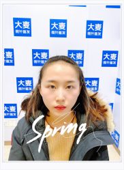 体验后-大麦微针植发全国连锁