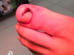 -新甲连锁灰指甲·甲沟炎·鸡眼(黑龙江路店)