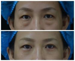 体验前-西美医疗美容门诊部