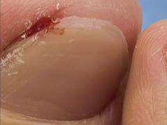 -郑远元专业修脚房(海防路店)