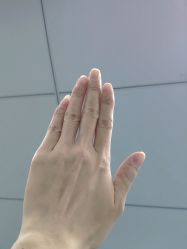 -蕾特恩专业祛痘