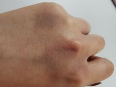 -悦和堂中医门诊部·疼痛调理·针灸推拿·艾灸拔罐