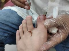 -新甲连锁灰指甲·甲沟炎·鸡眼(黑龙江路店)