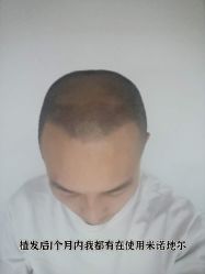 -雍禾植发全国连锁