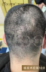 -熙朵美学植发·连锁品牌