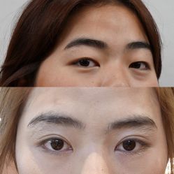 -素美医疗美容·西南眼鼻整形·修复基地
