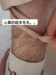 -薇兰专业脱毛连锁机构