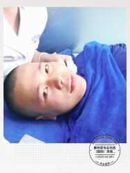 -蕾特恩专业祛痘