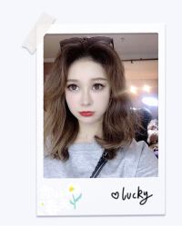 体验后-大麦微针植发全国连锁