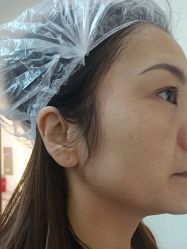 -长沙雅美医疗美容医院