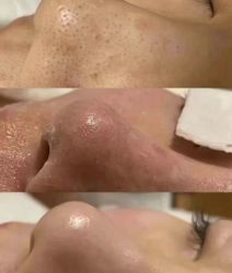 点击看大图 -VE专注问题肌·赛诺龙&科学美肤中心