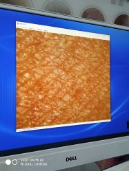 -痘博士烟台·全国连锁祛痘机构