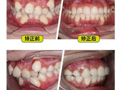 -柏乐口腔(南宁总院)