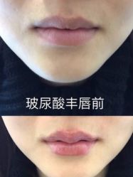-上海伊莱美医疗美容医院
