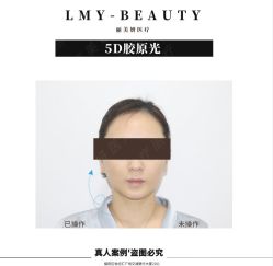 -丽美妍医疗美容·皮秒·立体分层抗衰