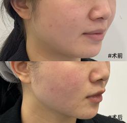 -杭州医巢医疗美容