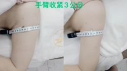 -Lily纤美·科技减脂中心