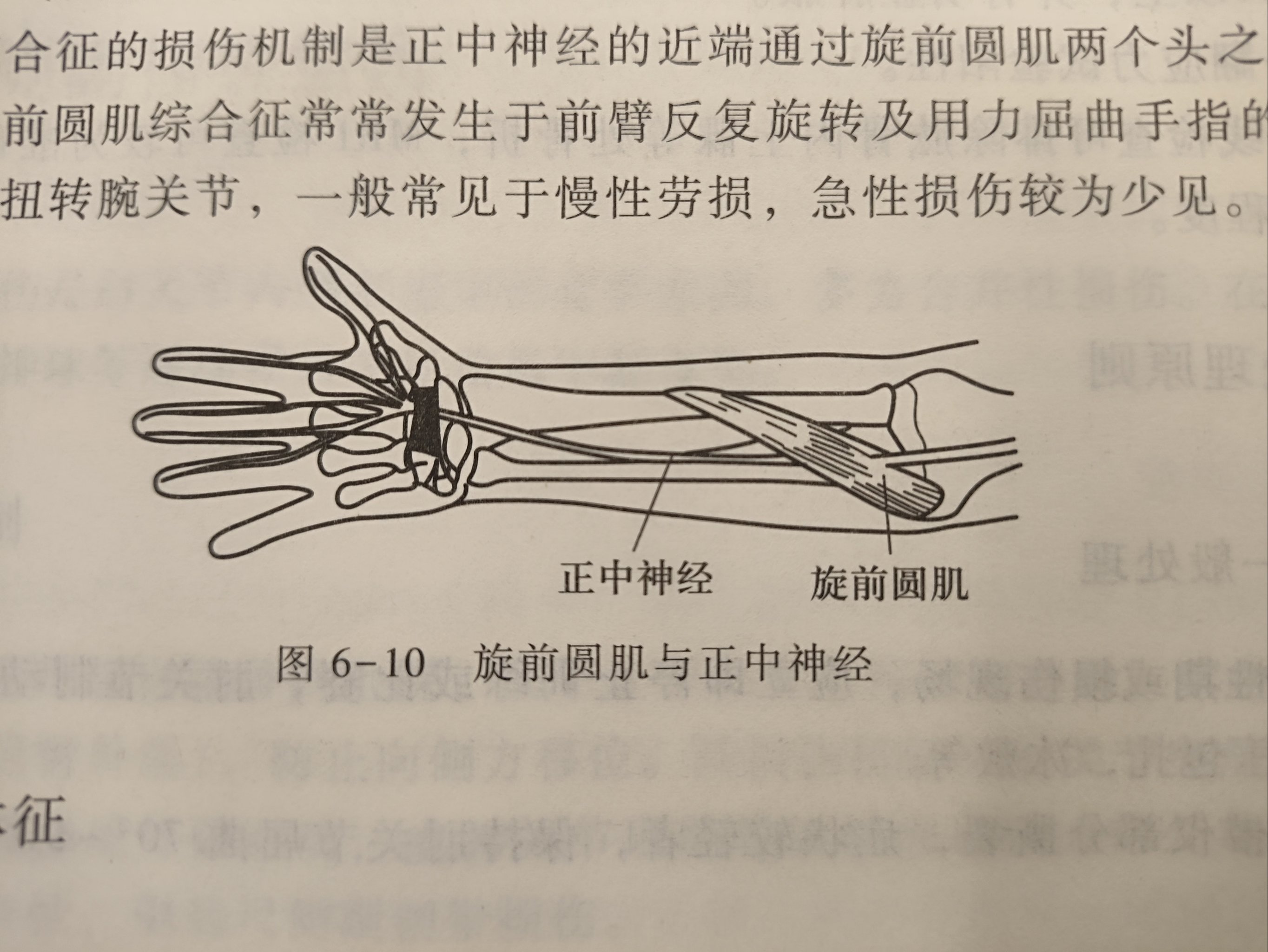 旋前圆肌位置图片图片