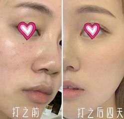 -MLP美丽派·问题肌疗愈中心
