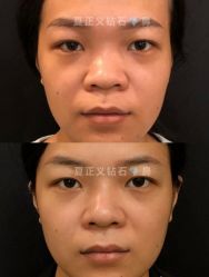 -北京米扬丽格医疗美容·联合丽格鼻整形中心