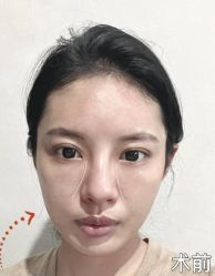 -素美医疗美容·西南眼鼻整形·修复基地