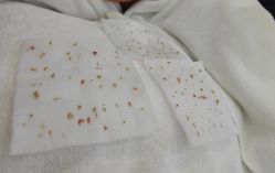 -蕾特恩专业祛痘·皮肤管理