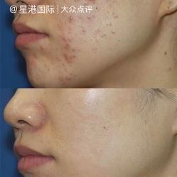-星港国际·Skin皮肤专研·皮肤管理
