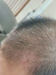 -雍禾植发全国连锁