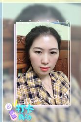 -大麦微针植发全国连锁