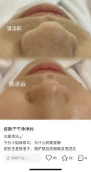-LUNA皮相美·骨相美高级美感