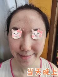 -洁铭新加坡医美