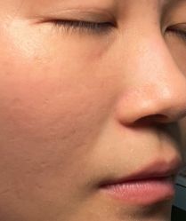 体验前-澳尔颜选医疗美容