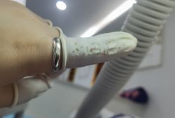 -蕾特恩专业祛痘·皮肤管理