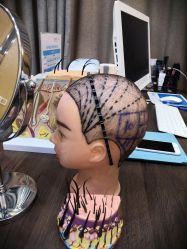 -雍禾植发全国连锁