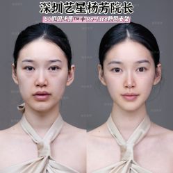 -深圳艺星医疗美容医院