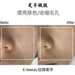 -E.beauty驻颜·痘敏肌调理中心