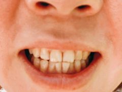 -安柏口腔(海珠世纪云顶店)