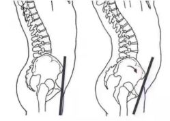 -卡莫瑜伽·普拉提