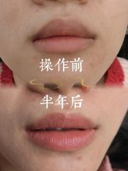 点击看大图 -西施无菌半永久纹绣眉眼影唇轻增发纹发际线