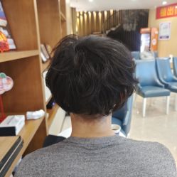 -大麦微针植发全国连锁