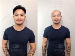 -发饰美男士增发补发假发定制店