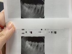 -北京大学口腔医院(第一门诊部)