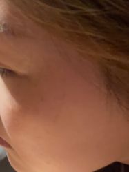 体验后-上海玫瑰医疗美容医院