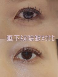 -上海漾颜医疗美容