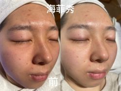 -栖SPA·ONDA ·海菲秀·皑皑科技美肤中心
