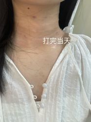 体验后-武汉五洲整形外科医院