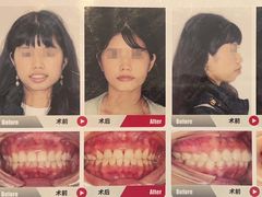 -爱齿尔口腔医院(中南院)