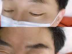 -西施无菌半永久纹绣眉眼影唇轻增发纹发际线